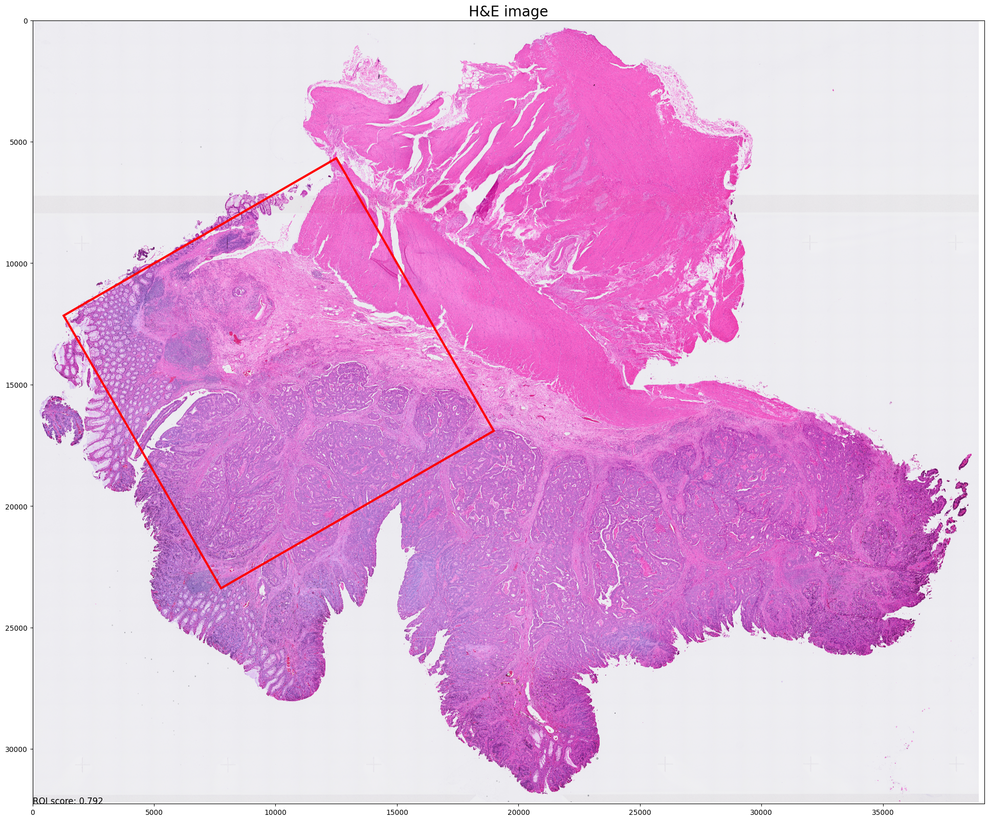 ../_images/notebooks_Tutorial_1_VisiumHD_ROI_selection_colon_12_4.png