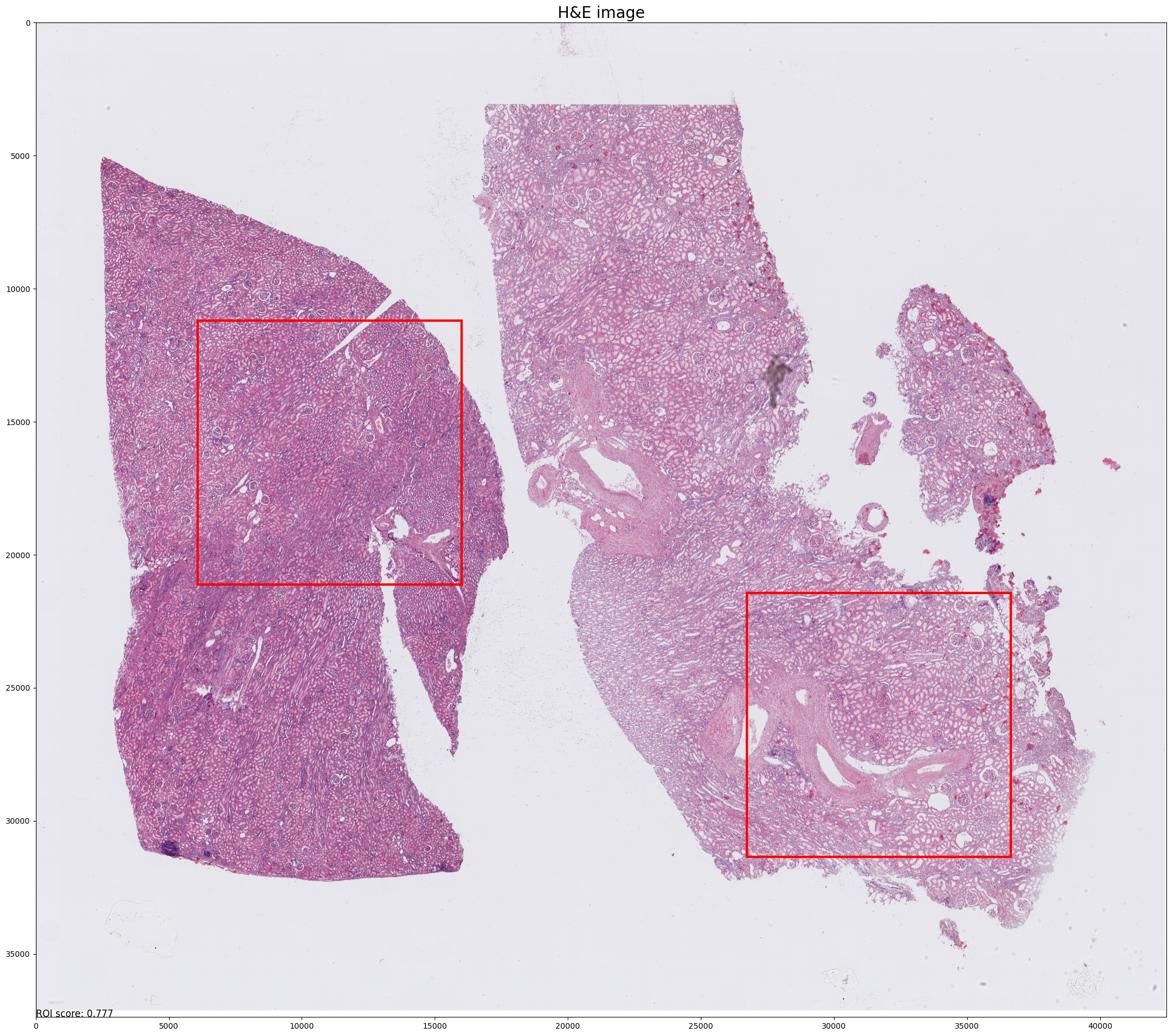 ../_images/notebooks_Tutorial_2_CosMx_FOV_selection_kidney_12_7.png