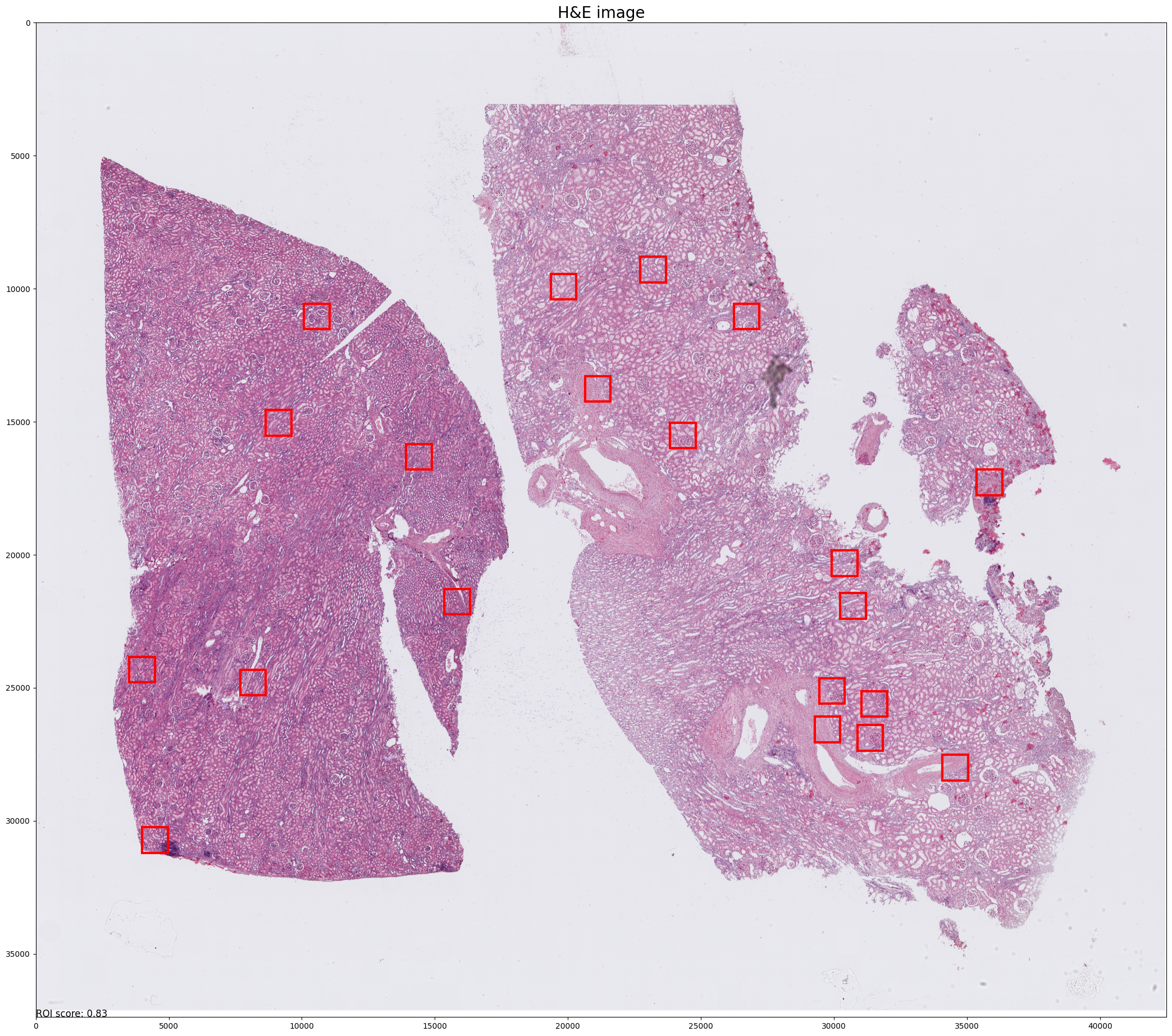 ../_images/notebooks_Tutorial_2_CosMx_FOV_selection_kidney_14_65.png