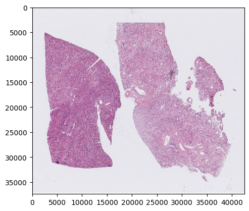 ../_images/notebooks_Tutorial_2_CosMx_FOV_selection_kidney_2_1.png