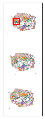 ../_images/notebooks_Tutorial_3_Consecutive_ROI_selection_breast_10_3.png