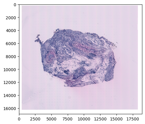../_images/notebooks_Tutorial_3_Consecutive_ROI_selection_breast_2_1.png
