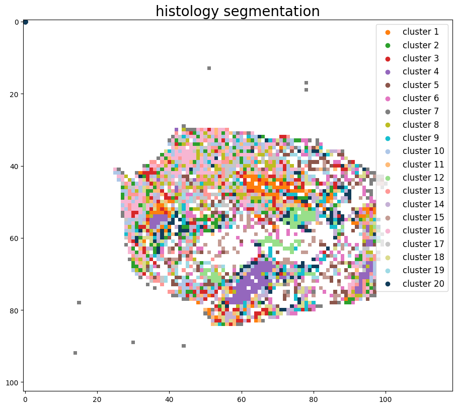 ../_images/notebooks_Tutorial_3_Consecutive_ROI_selection_breast_8_3.png