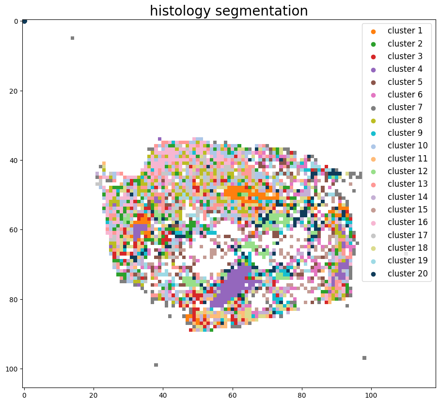 ../_images/notebooks_Tutorial_3_Consecutive_ROI_selection_breast_8_4.png