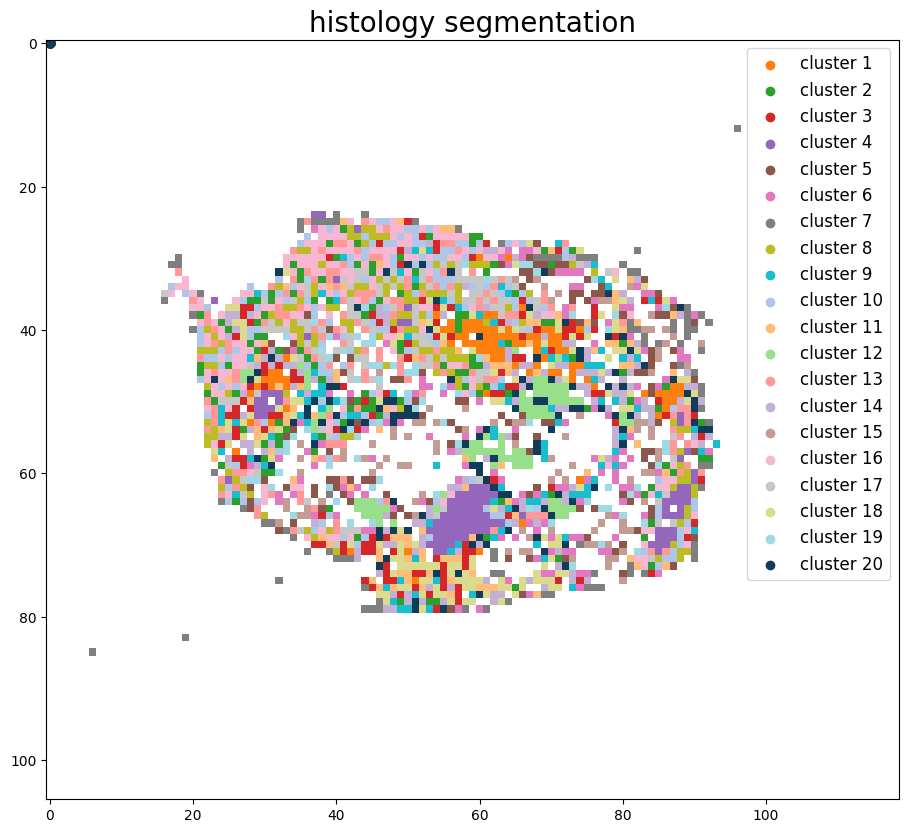 ../_images/notebooks_Tutorial_3_Consecutive_ROI_selection_breast_8_5.png
