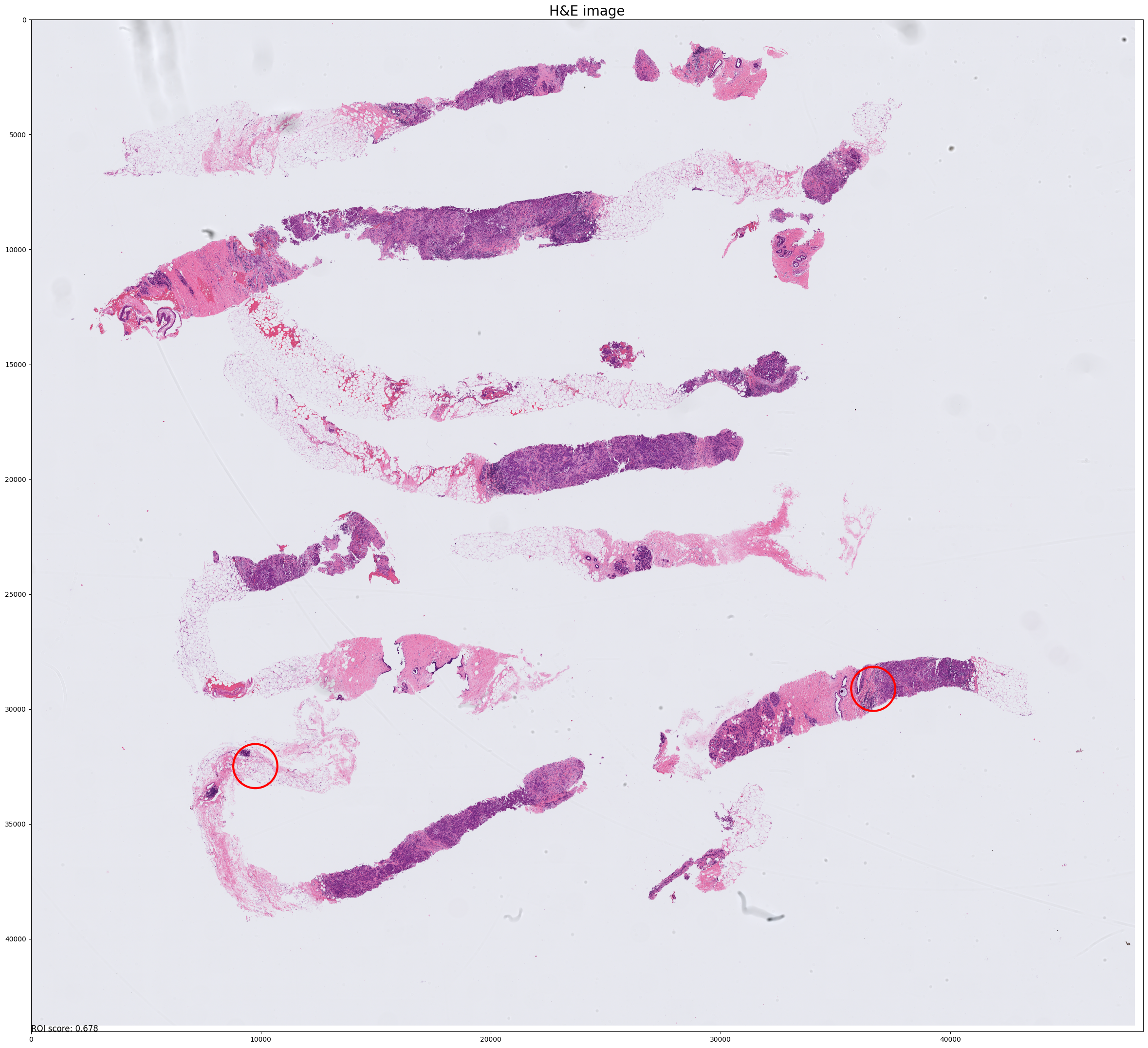 ../_images/notebooks_Tutorial_4_TMA_selection_breast_12_13.png