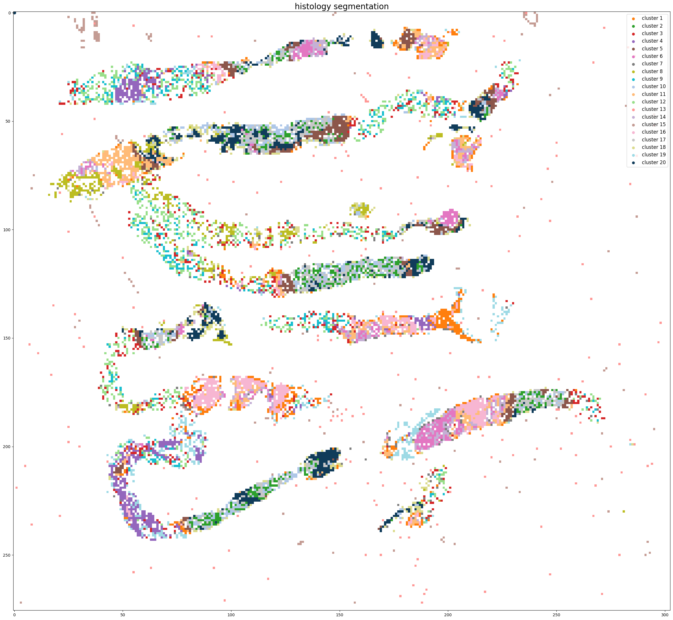 ../_images/notebooks_Tutorial_4_TMA_selection_breast_8_1.png